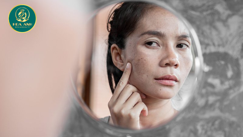 8 cách làn da phản ánh sự căn thẳng bên trong bạn